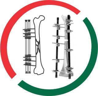 EXTERNAL FIXATOR zimbabwe