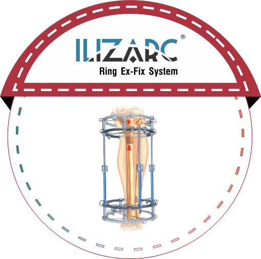 ILIZARC malaysia
