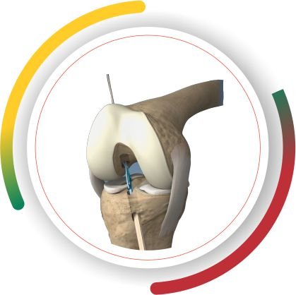 KNEE & SHOULDER Lithuania