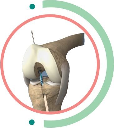 KNEE & SHOULDER dubai