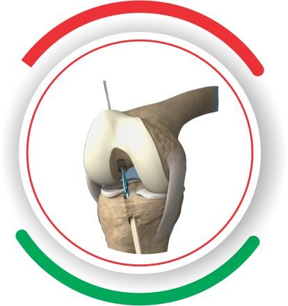 KNEE & SHOULDER lebanon