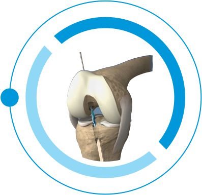 KNEE & SHOULDER tanzania