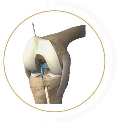 KNEE & SHOULDER thailand