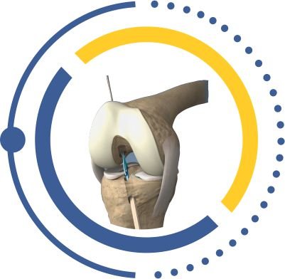 KNEE & SHOULDER ukraine