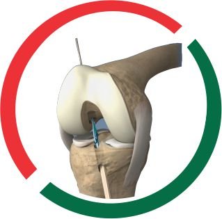 KNEE & SHOULDER zimbabwe