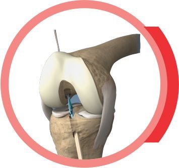 KNEE & SHOULDER