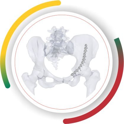 LOW PROFILE PELVIS Lithuania