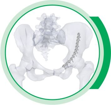 LOW PROFILE PELVIS niger