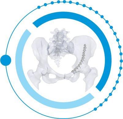 LOW PROFILE PELVIS tanzania
