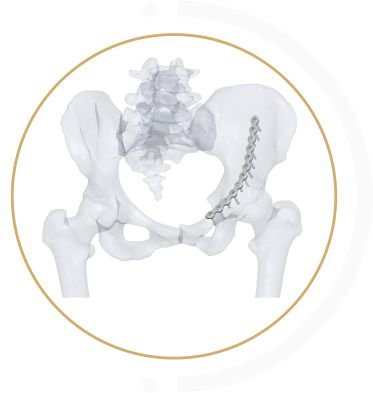 LOW PROFILE PELVIS thailand