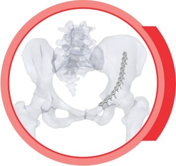 LOW PROFILE PELVIS