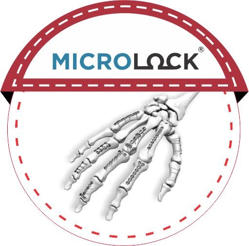 MICROLOCK malaysia
