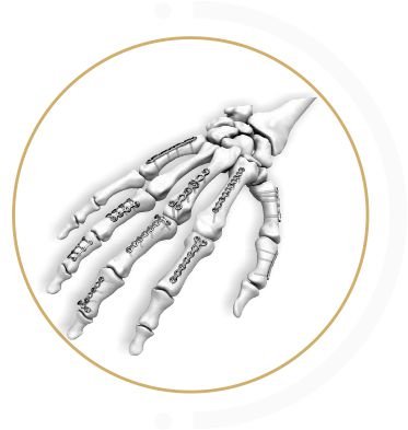 MICROLOCK thailand