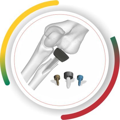 RADIAL HEAD Lithuania