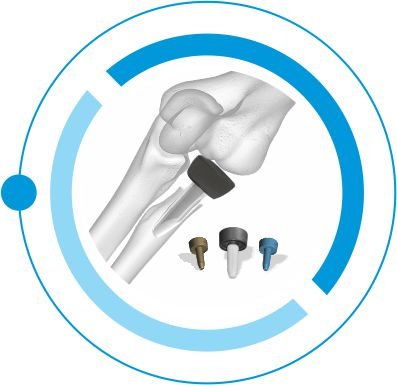 RADIAL HEAD tanzania