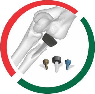 RADIAL HEAD zimbabwe
