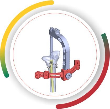 SUPRAPATELLAR Lithuania