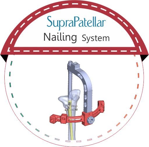 SUPRAPATELLAR malaysia