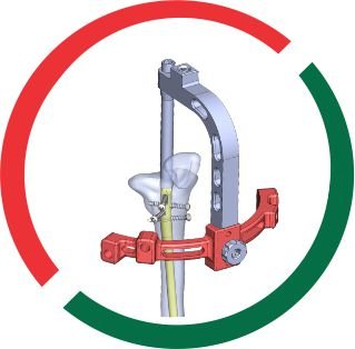 SUPRAPATELLAR zimbabwe