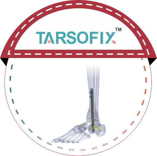 TARSOFIX malaysia