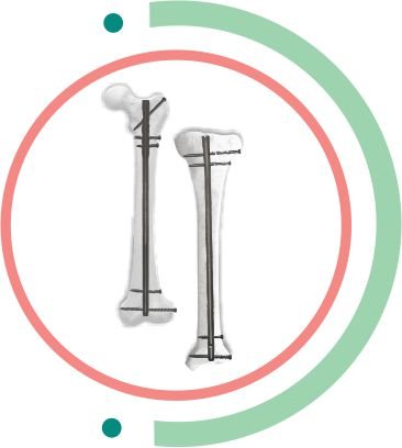 TIBIA FEMUR dubai