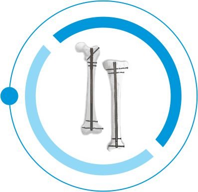 TIBIA FEMUR tanzania