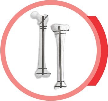TIBIA FEMUR
