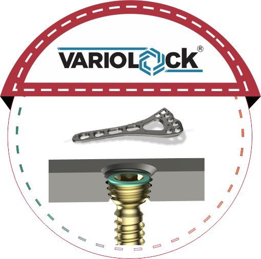 VARIOLOCK malaysia