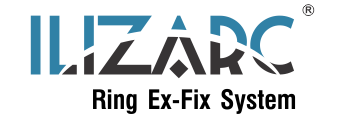 ILIZARC