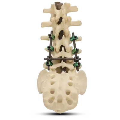 spine cover image