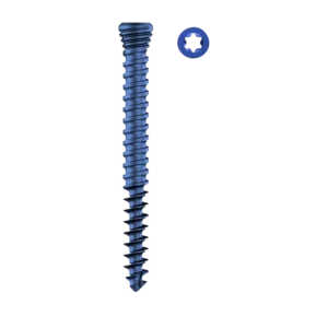 DTN Dual Core Locking Screw Star Drive – Titanium (Dia 4.0mm)