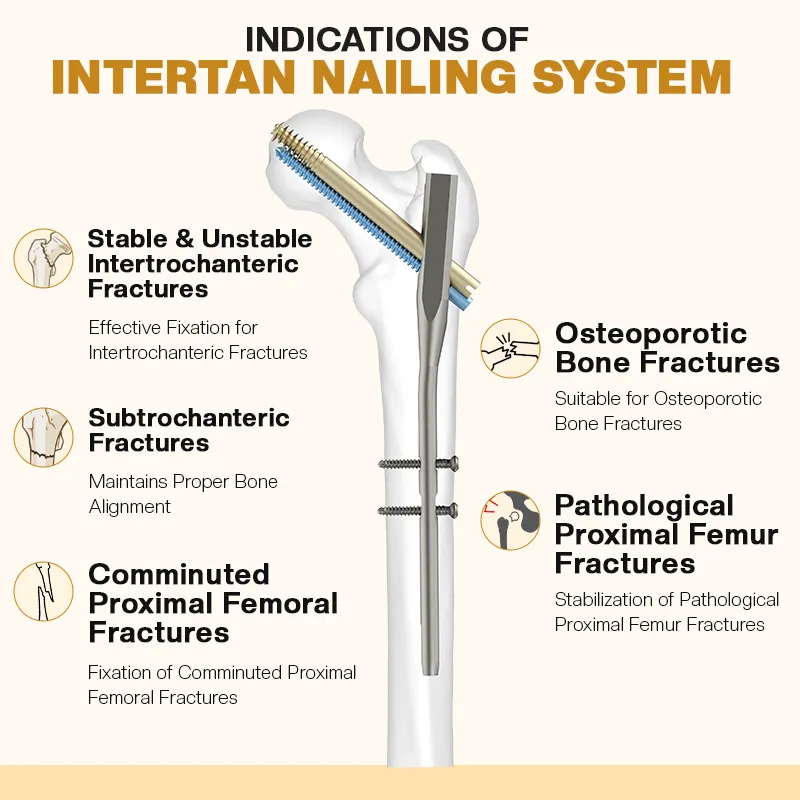 Indications of Intertan