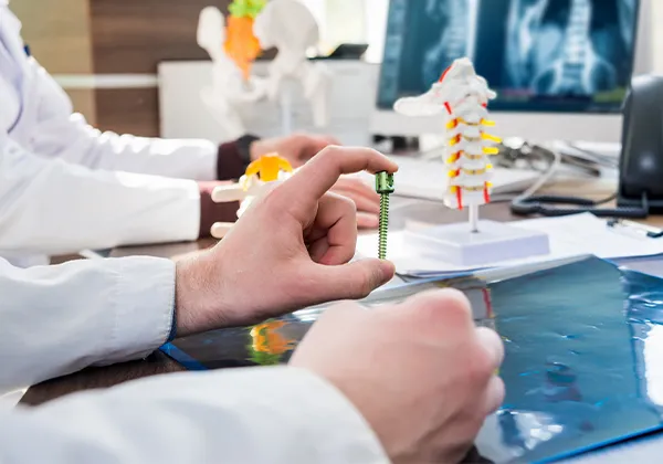 Choose Siora’s Spine Implant Solutions