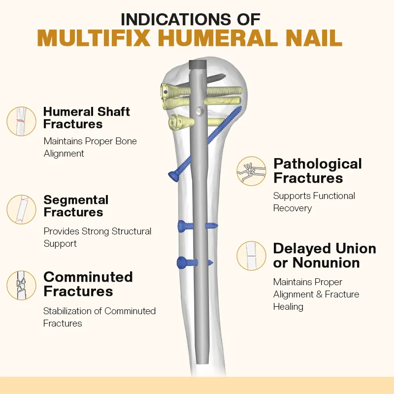 Indications of Multi-Locking Humerus Nail