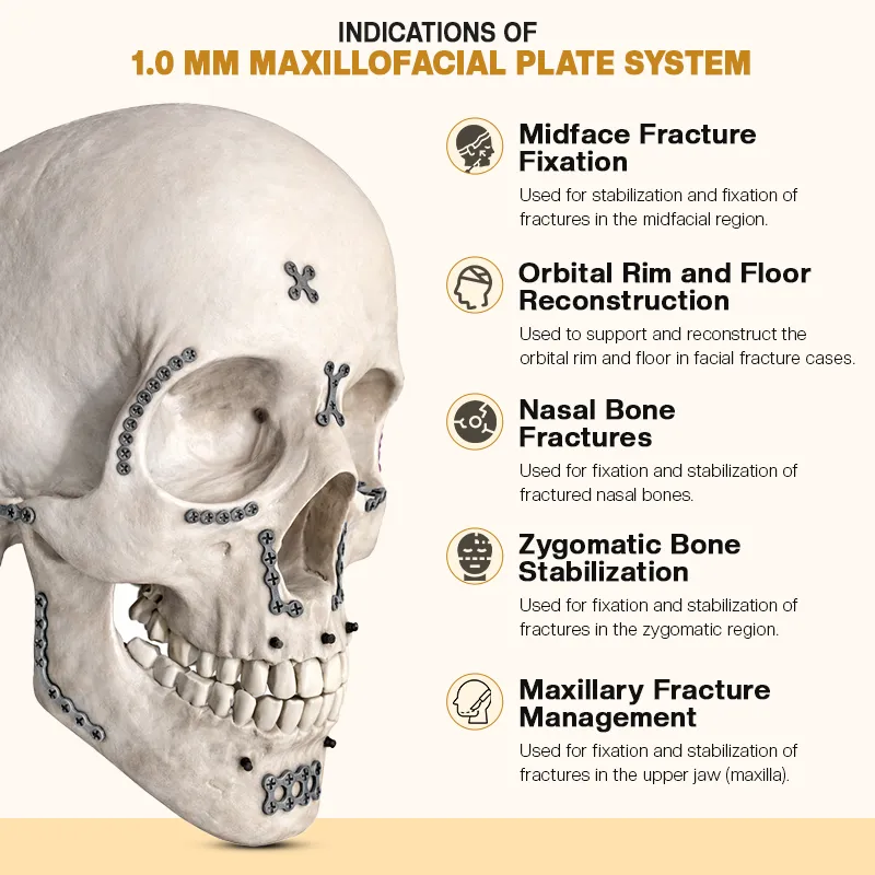 Key Indications of 1.0 mm Maxillofacial Plate System