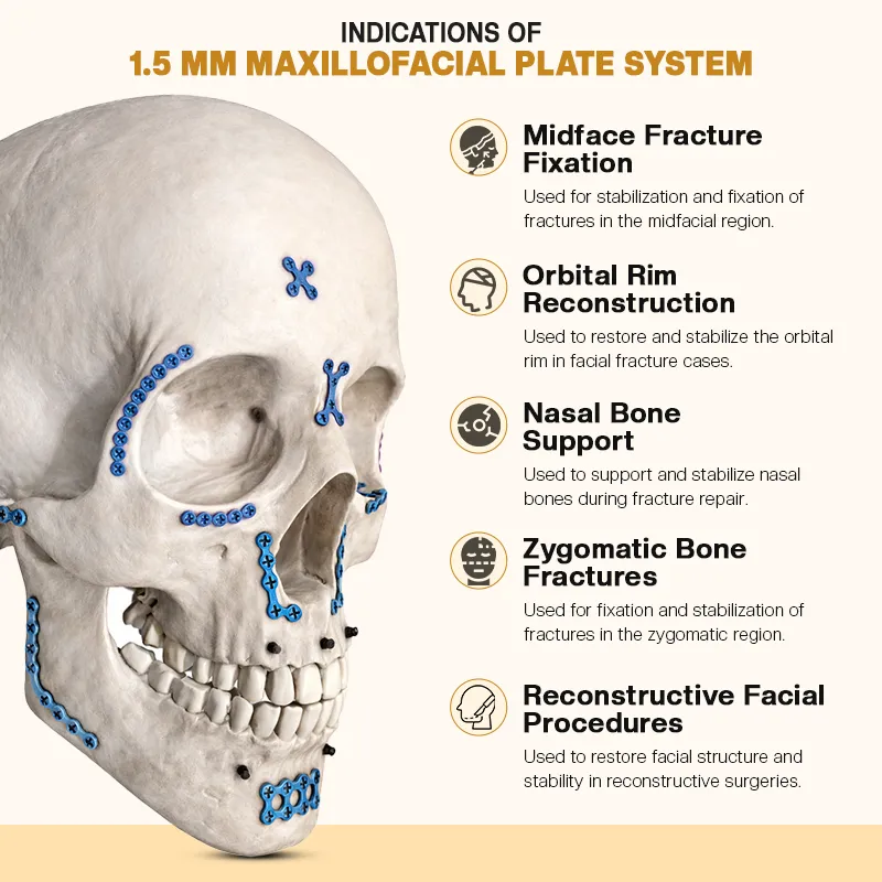 Key Indications of 1.5 mm Maxillofacial Plate System