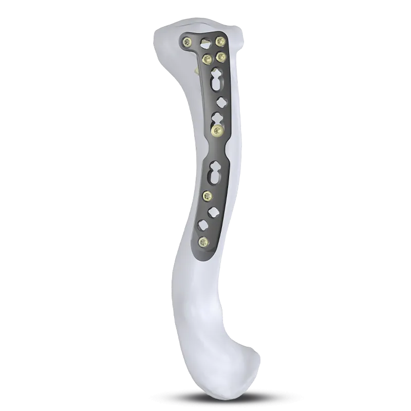 Locking Clavicle Plate with bone
