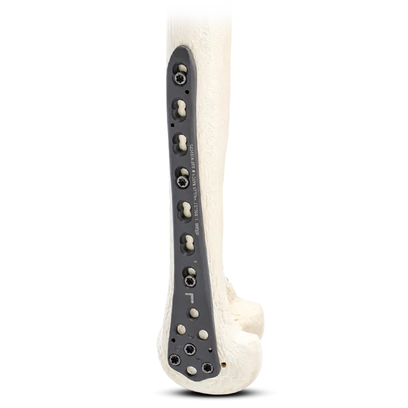 Locking Distal Femur Plate Locking Distal Femur Plate