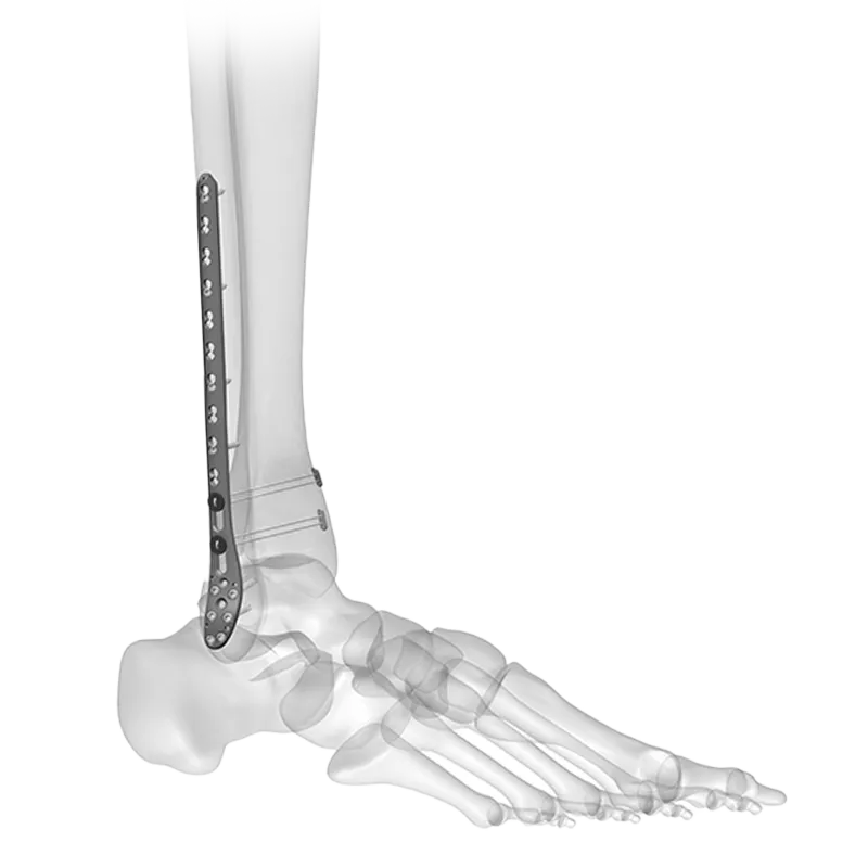 Ankle image category