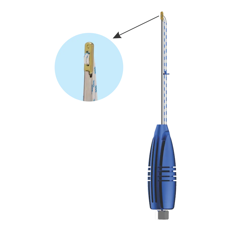 Flex Rope for Syndesmosis Repair, titanium – Sterile