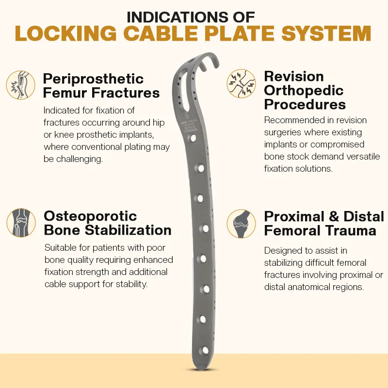 Locking Cable Plate System | Orthopedic Fixation Solutions