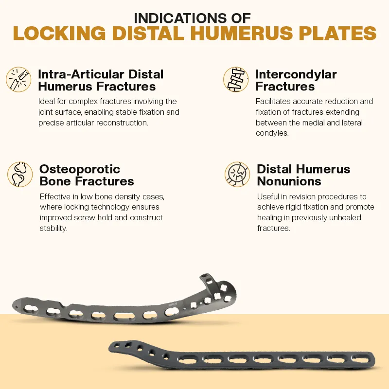 Key Indications of Distal Humerus Fracture Plates