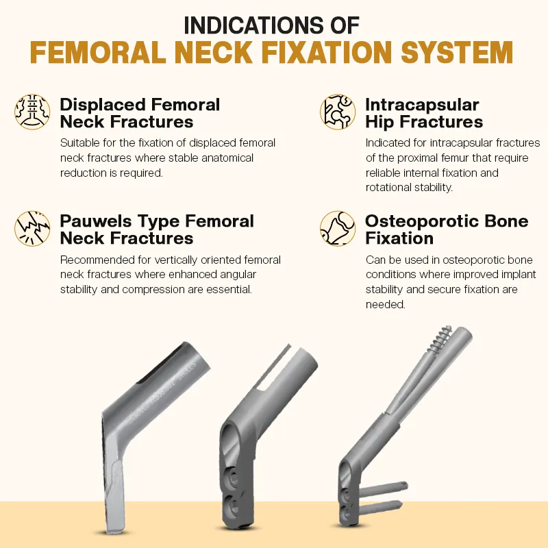 Key Indications of FNS Femoral Neck System