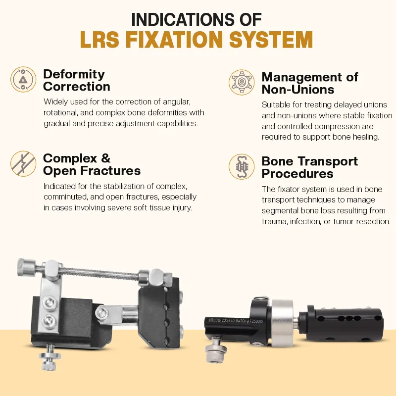 Key Indications of LRS Fixator