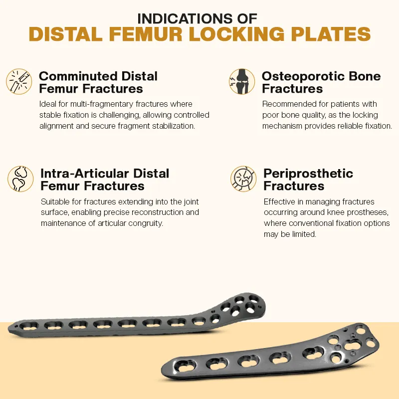 Key Indications of Locking Plates for Distal Femur Fractures