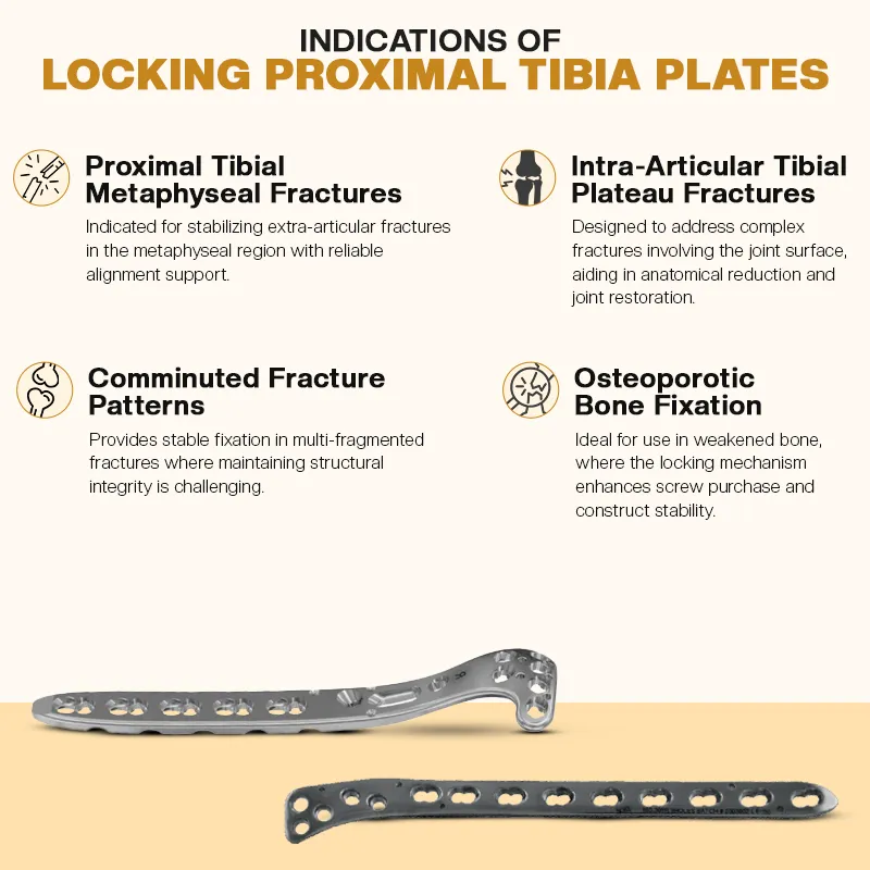 Key Indications of Proximal Tibial Locking Plates