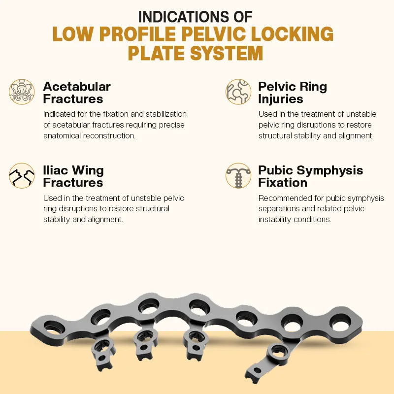 Key Indications of the Low Profile Pelvic Plates and Screw System