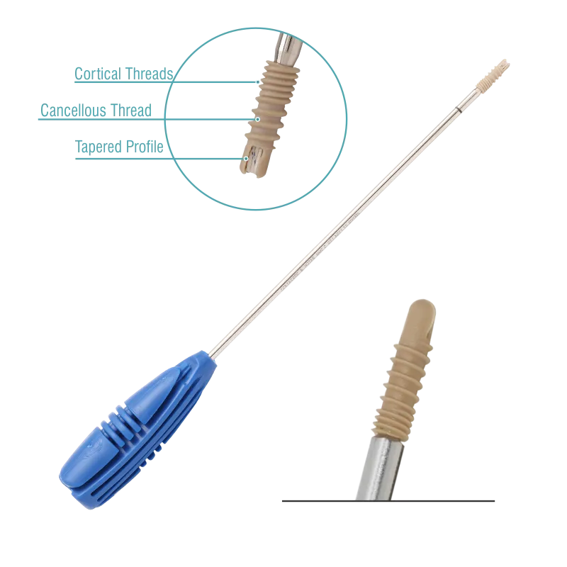 Pre Loaded Anchor – Peek – (Sterile)
