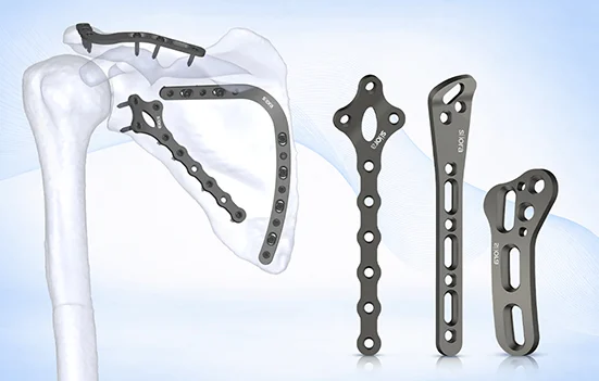 Scapula Plating System