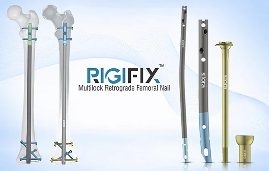 Multilock Retrograde Femoral Nail